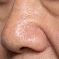 What skincare reduces pore size?