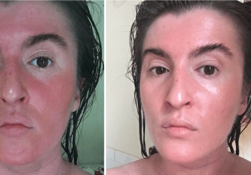 Do skincare routines actually work?