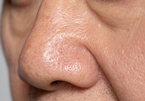 What skincare reduces pore size?